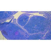 Tissue Control Slide, Amyloid